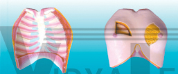 The dissection model of breast